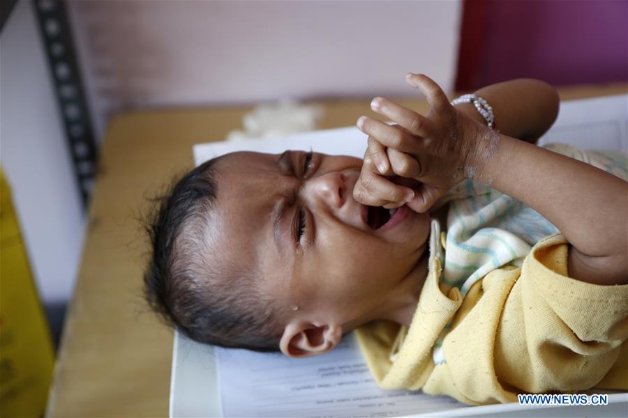 YEMEN-SANAA-CHILDREN-MALNUTRITION